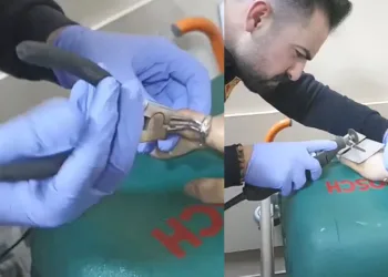 Parmağına sıkışan yüzüğü itfaiye çıkardı