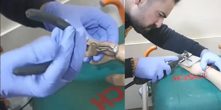 Parmağına sıkışan yüzüğü itfaiye çıkardı