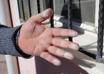 Acil Servis ekiplerinin toz çilesi