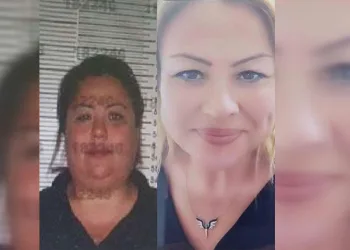 Film gibi olay: Yakalanmamak için yüzüne estetik yaptırdı
