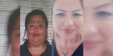 Film gibi olay: Yakalanmamak için yüzüne estetik yaptırdı