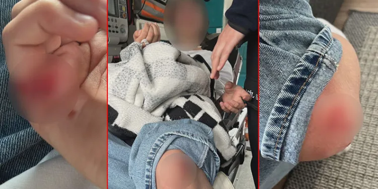 15 yaşındaki çocuğa sokak köpekleri saldırdı