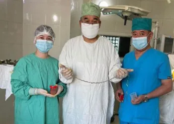 Çocuğun beyninden saç çıktı