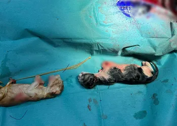 Bilecik’te kedi sezaryenle doğum yaptı