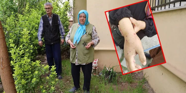 Sokak köpeklerinin saldırısına uğradı