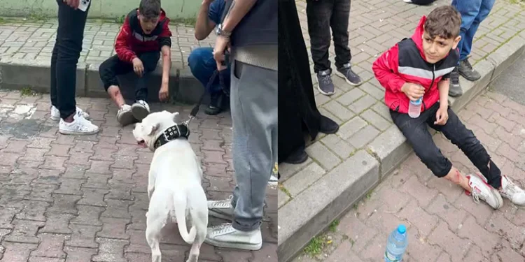 Başıboş bir köpek 12 yaşındaki çocuğu ısırdı