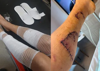 Sahibini kıskanarak bacağını parçaladı
