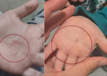 Kreşde 4 yaşındaki çocuğa şiddet iddiası