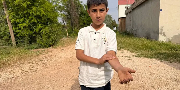 Yerleşim yerine inen kurt 2 çocuğa saldırdı