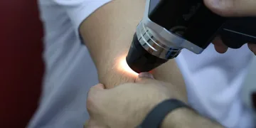 Deri kanserinde erken teşhisin önemi