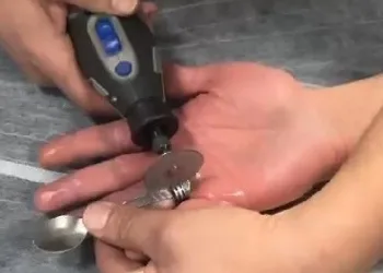 Parmağa sıkışan yüzük kesilerek çıkarıldı