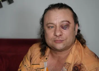 Sanatçı ve magazinci Onur Akay saldırıya uğradı