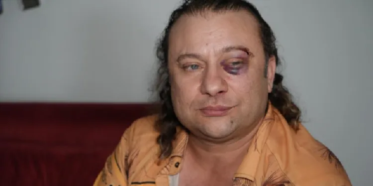 Sanatçı ve magazinci Onur Akay saldırıya uğradı