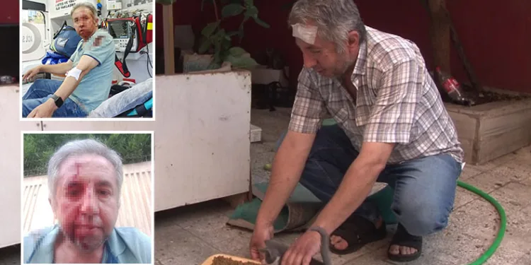 Sokak hayvanlarını beslediği için darp edildi