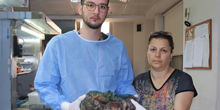 Karın ağrısı şikayetiyle gitti, gördüğüne inanamadı