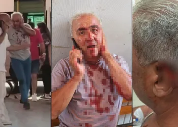 Yolcu, minibüs şoförünün kulağını ısırarak koparttı