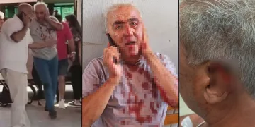 Yolcu, minibüs şoförünün kulağını ısırarak koparttı
