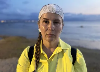 Denizde yüzerken jet ski çarptı