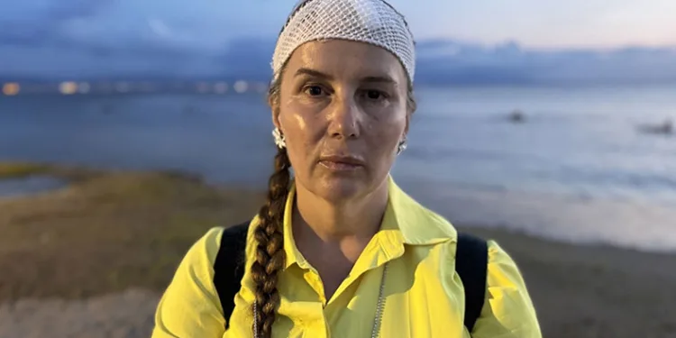 Denizde yüzerken jet ski çarptı
