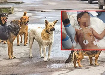 5 yaşındaki çocuk sokak köpeklerinin saldırısına uğradı