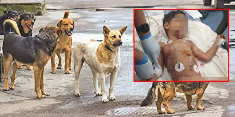 5 yaşındaki çocuk sokak köpeklerinin saldırısına uğradı