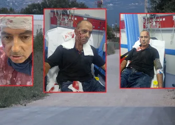 Bursa’da tarla sulamaya giden şahıs, köpek saldırısına uğradı