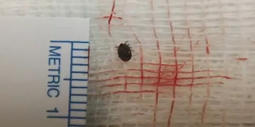 Hastanın gözünde canlı kene çıktı