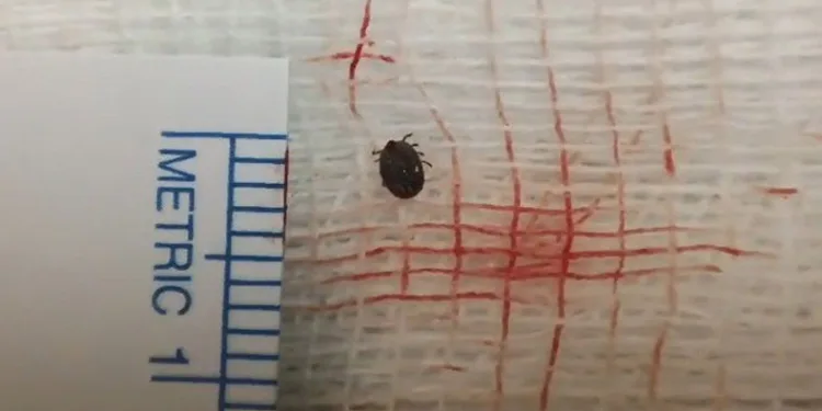 Hastanın gözünde canlı kene çıktı