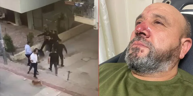 Park tartışmasında imamı hastanelik ettiler