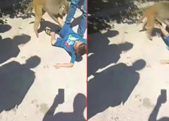 Adana’da maymun çocuğa saldırdı