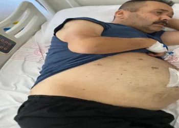 Mide küçültme ameliyatı hayatına mal oldu
