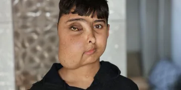 Enes gen tedavisiyle sağlığına kavuşacak