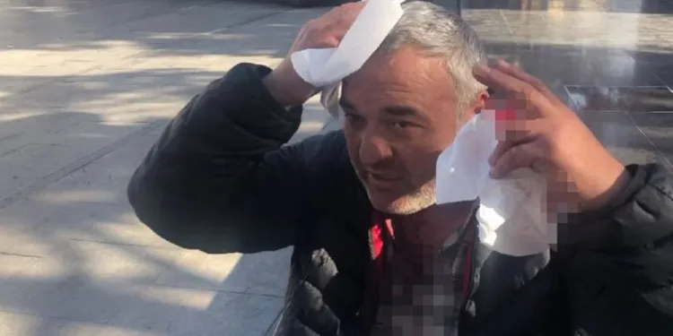 Çorlu’da trafik kazası: 2 yaralı