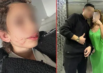Genç kızı darp eden şahıs: “Kendi kendini yaraladı”