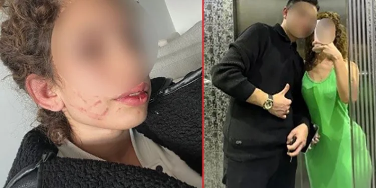 Genç kızı darp eden şahıs: “Kendi kendini yaraladı”