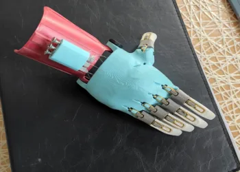 Üç boyutlu baskıyla protez el yapıldı