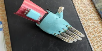 Üç boyutlu baskıyla protez el yapıldı