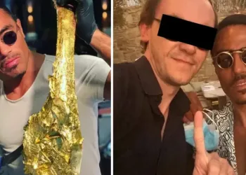 Meclis üyesinin başını yaktı