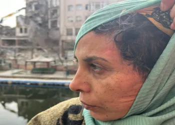 Lavabo açıcısı yüzüne patladı