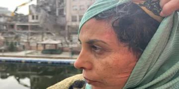 Lavabo açıcısı yüzüne patladı