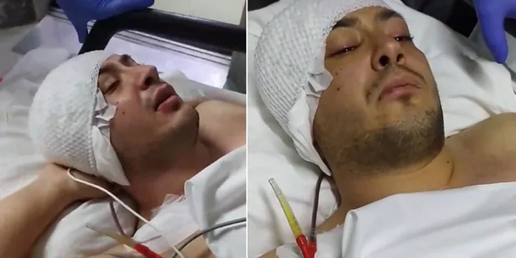 Adliye saldırısında yaralanan uzman çavuş hayata tutundu