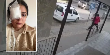 Yolda yürüyen genç kıza yumruklu saldırı