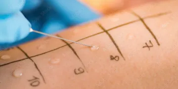 Alerji testlerinin zamanlaması çok önemli