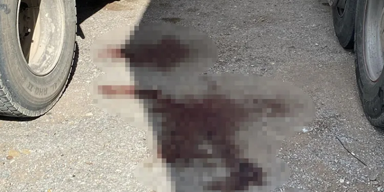 Eski sevgilisini ağır yaralayan zanlı tutuklandı