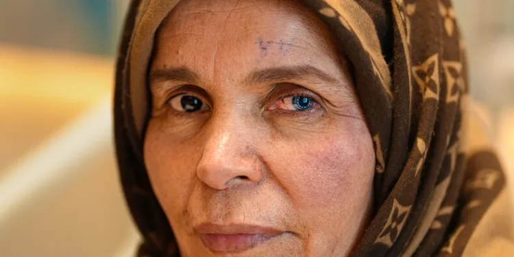 ‘Göremezsin’ denilen Libyalı Kadın Türkiye’de aydınlığa kavuştu