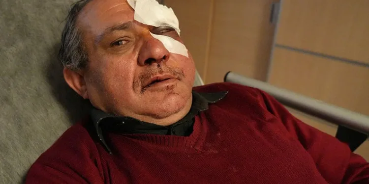 Ümraniye’de kuyumcudan 100 bin liralık altın bileklik çalan kadın yakalandı