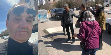 Köpeklerin toplanmasına destek veren vatandaşın burnunu kırdılar