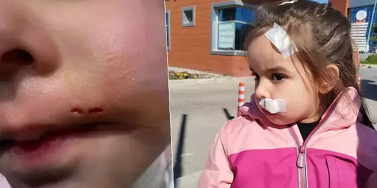 Başıboş köpek 3 yaşındaki Elif’e saldırdı