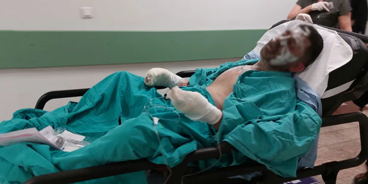 Yaktığı ateşe tiner döken şahıs ağır yaralandı