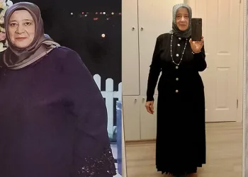 Azmetti 22 ayda çok zayıfladı